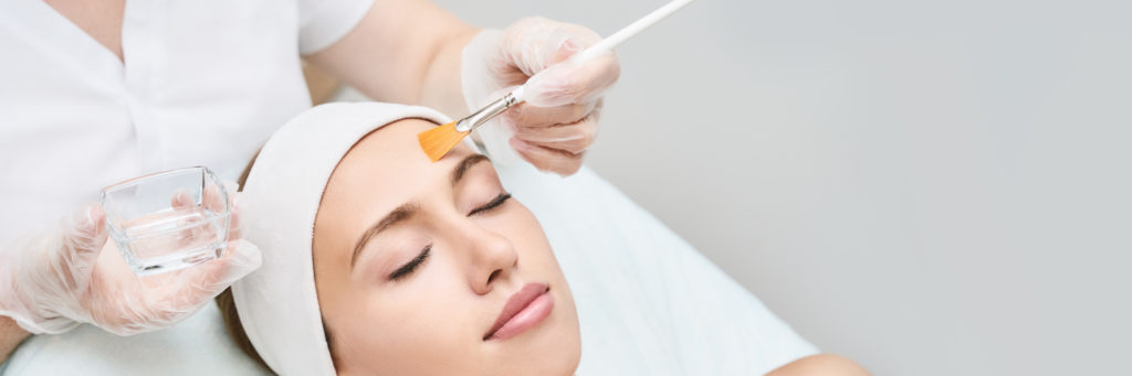 Can Acne Scars Be Treated by Chemical Peeling